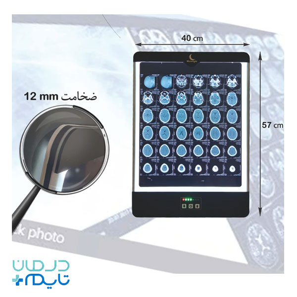 نگاتوسکوپ مون لایت مدل ML1-New