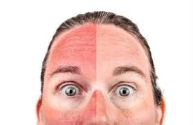 پماد زینک اکساید