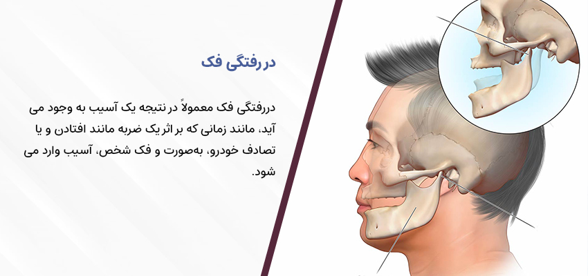 دررفتگی فک 