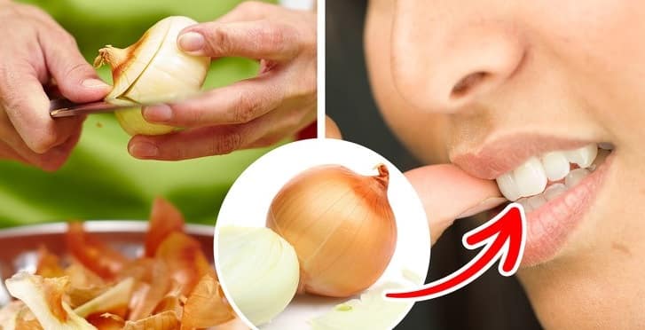 تسکین درد دندان با پیاز