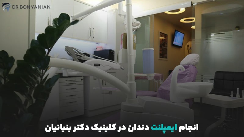 انجام ایمپلنت در کلینیک دکتربنیانیان - تصویر 3