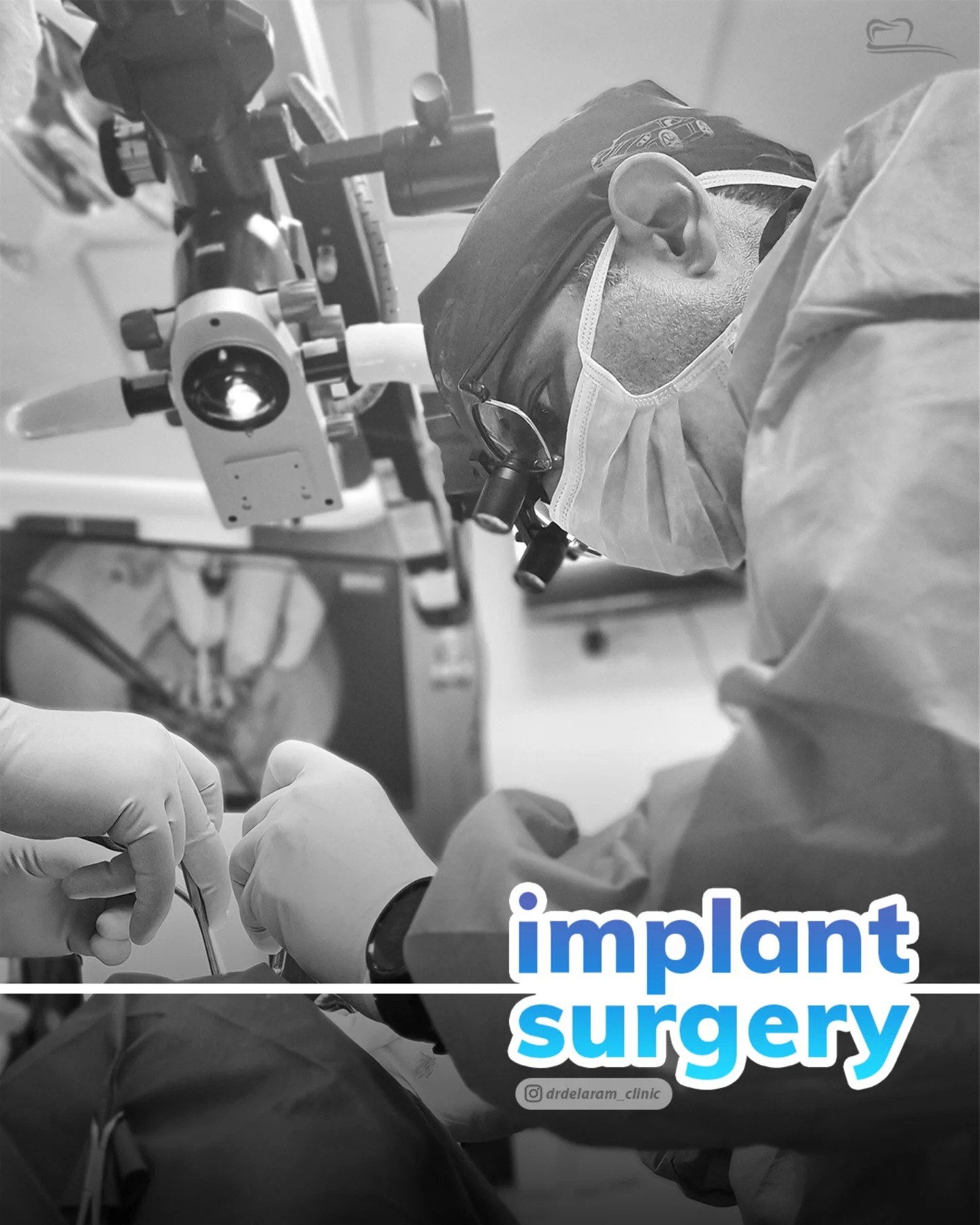 ایمپلنت دندان