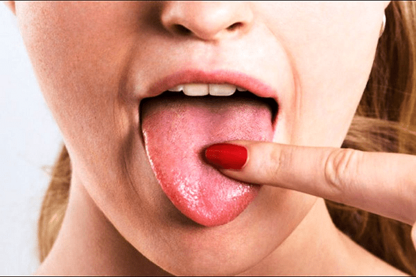 کم‌آبی بدن علت شوری دهان