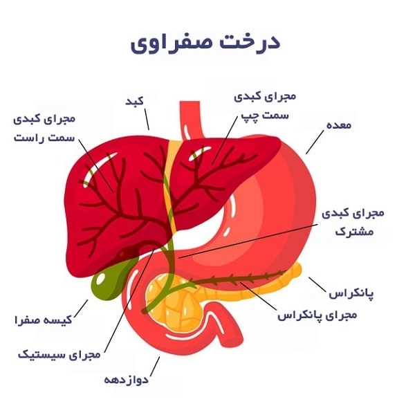درمان بیماری های مجاری صفراوی 