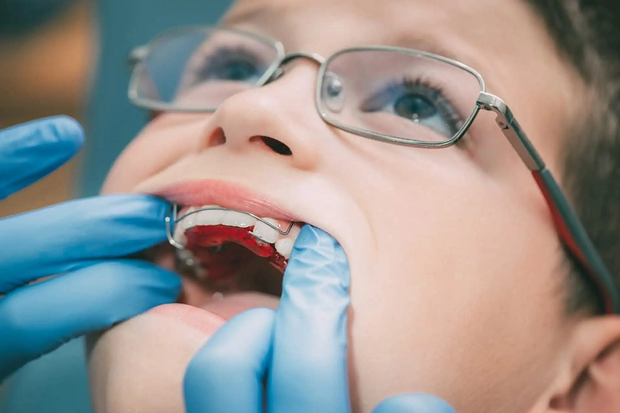 معاینات ارتودنسی پیشگیرانه در کودک