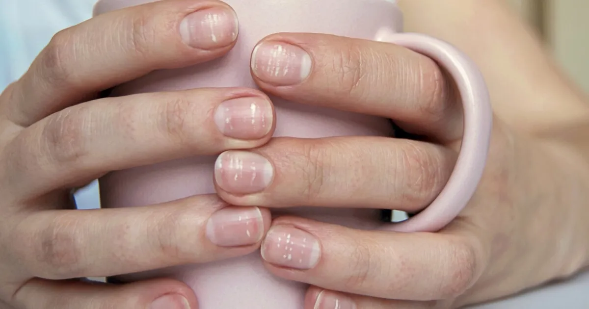 ساختار صفحه ناخن
