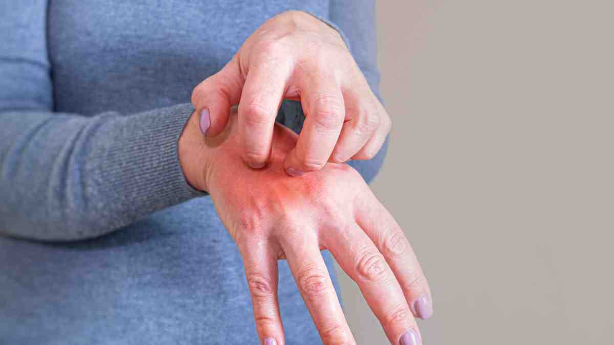 خارش بدن در شب