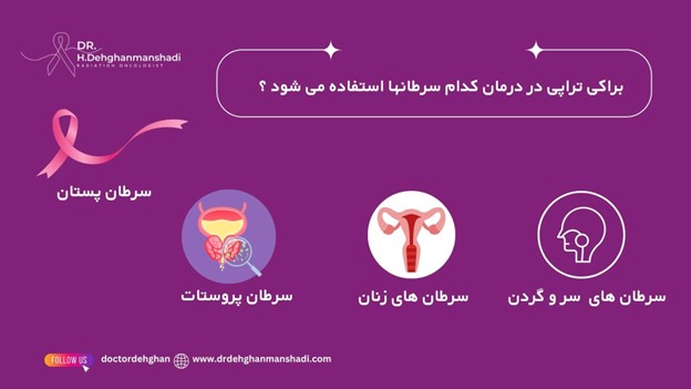 کاربرد براکی تراپی
